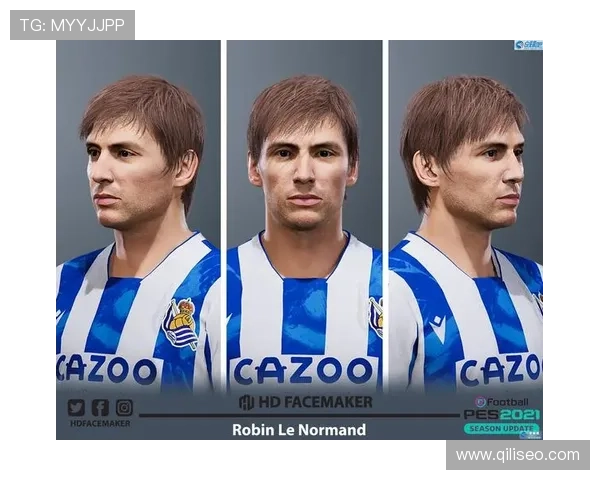 勒诺尔芒韧带无损伤恢复期预计为一个半至两个月